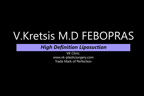 High Definition Liposuction - Dr. Kretsis MD